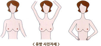 유방 사진자세