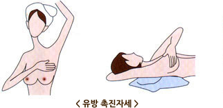 유방 촉진자세