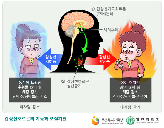 갑상선의 모양